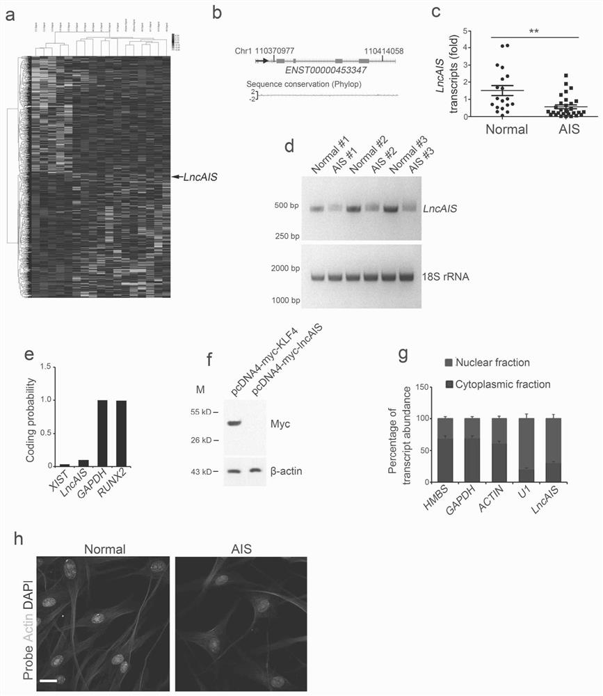 Application of hoxd8 in the preparation of products promoting osteogenic differentiation of bone marrow mesenchymal stem cells