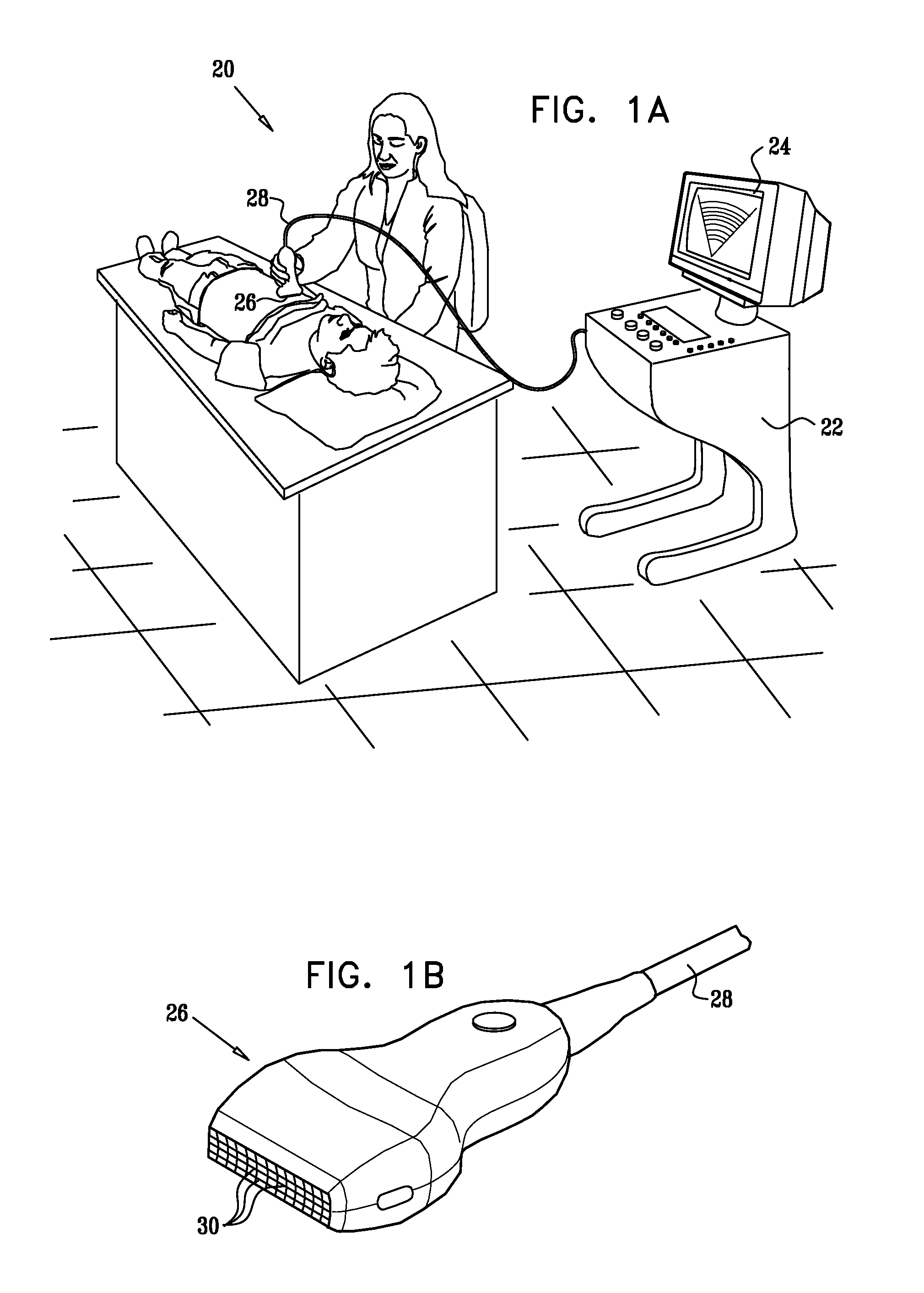 Clutter suppression in ultrasonic imaging systems