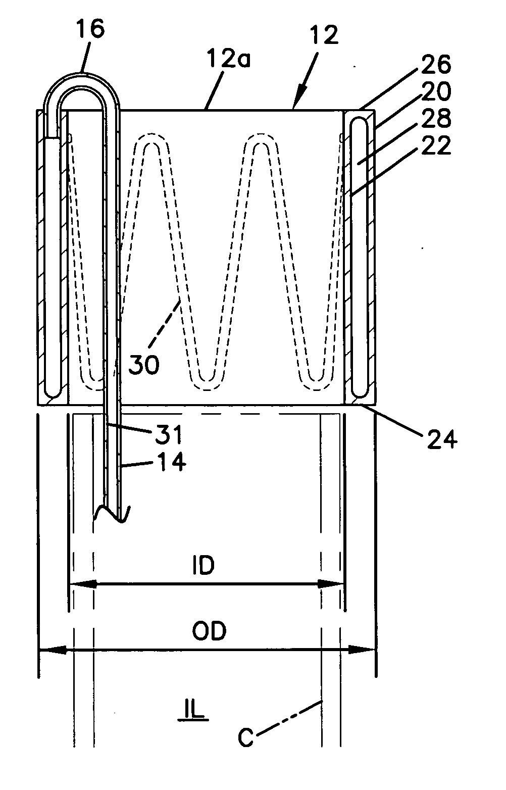 Vascular occlusion delivery