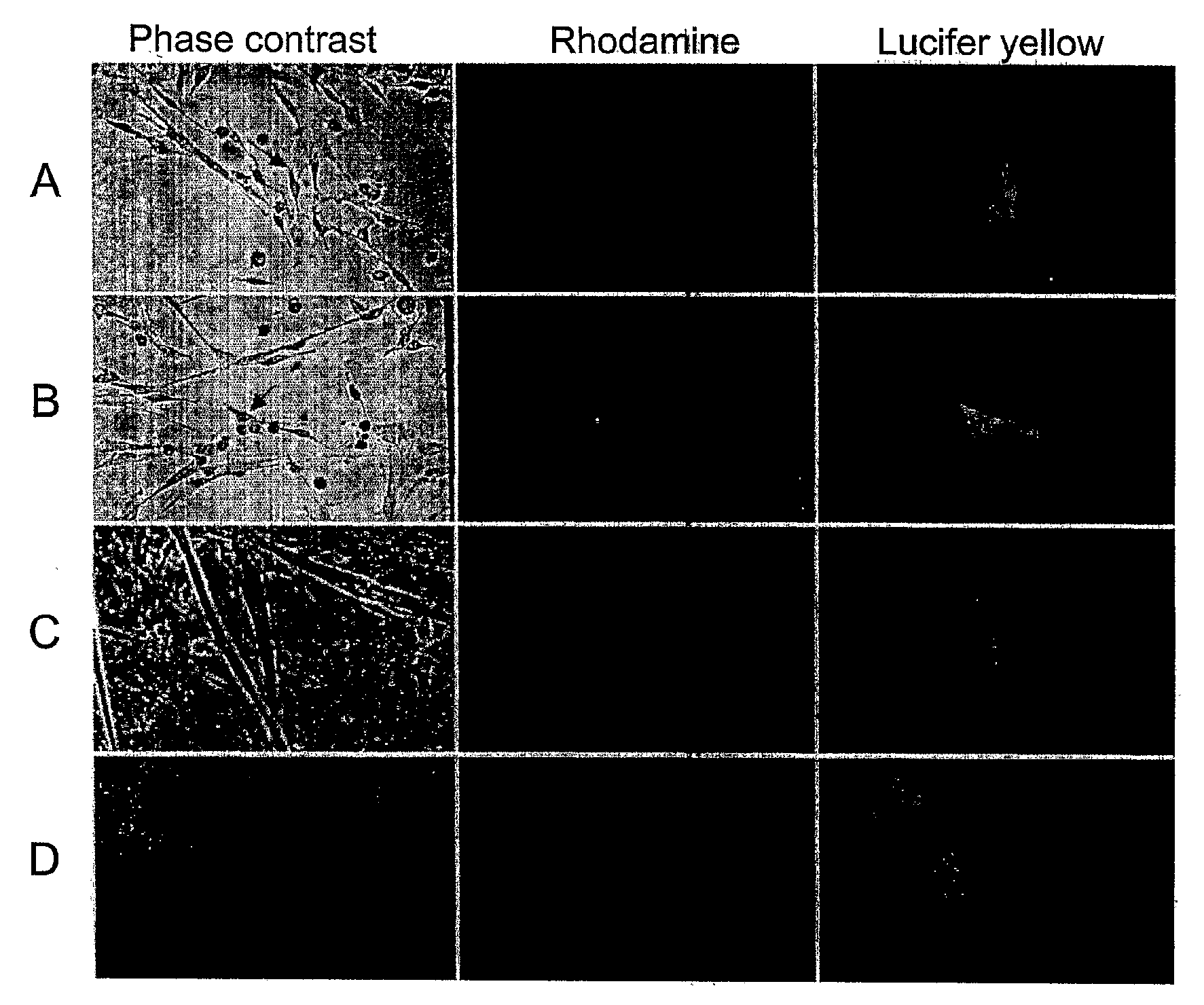 Methods and compositions for correction of cardiac conduction disturbances