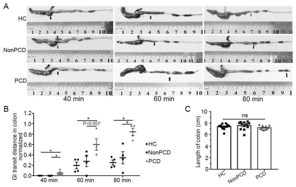 Use of 5-hydroxytryptamine receptor subtypes 3 and 4 and antagonists thereof in treatment of post-cholecystectomy diarrhea