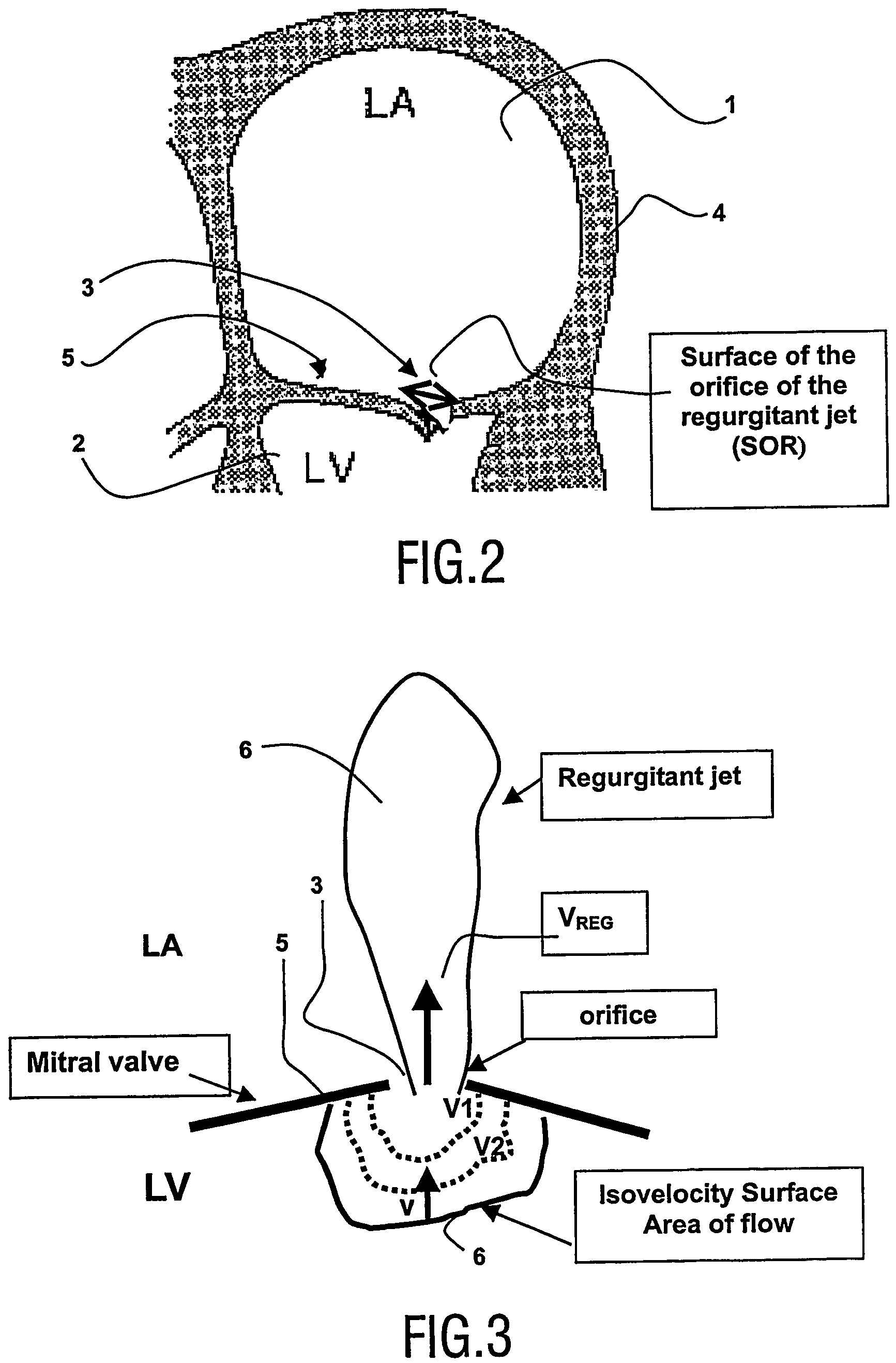 Viewing system having means for processing a sequence of ultrasound images for performing a quantitative estimation of flow in a body organ