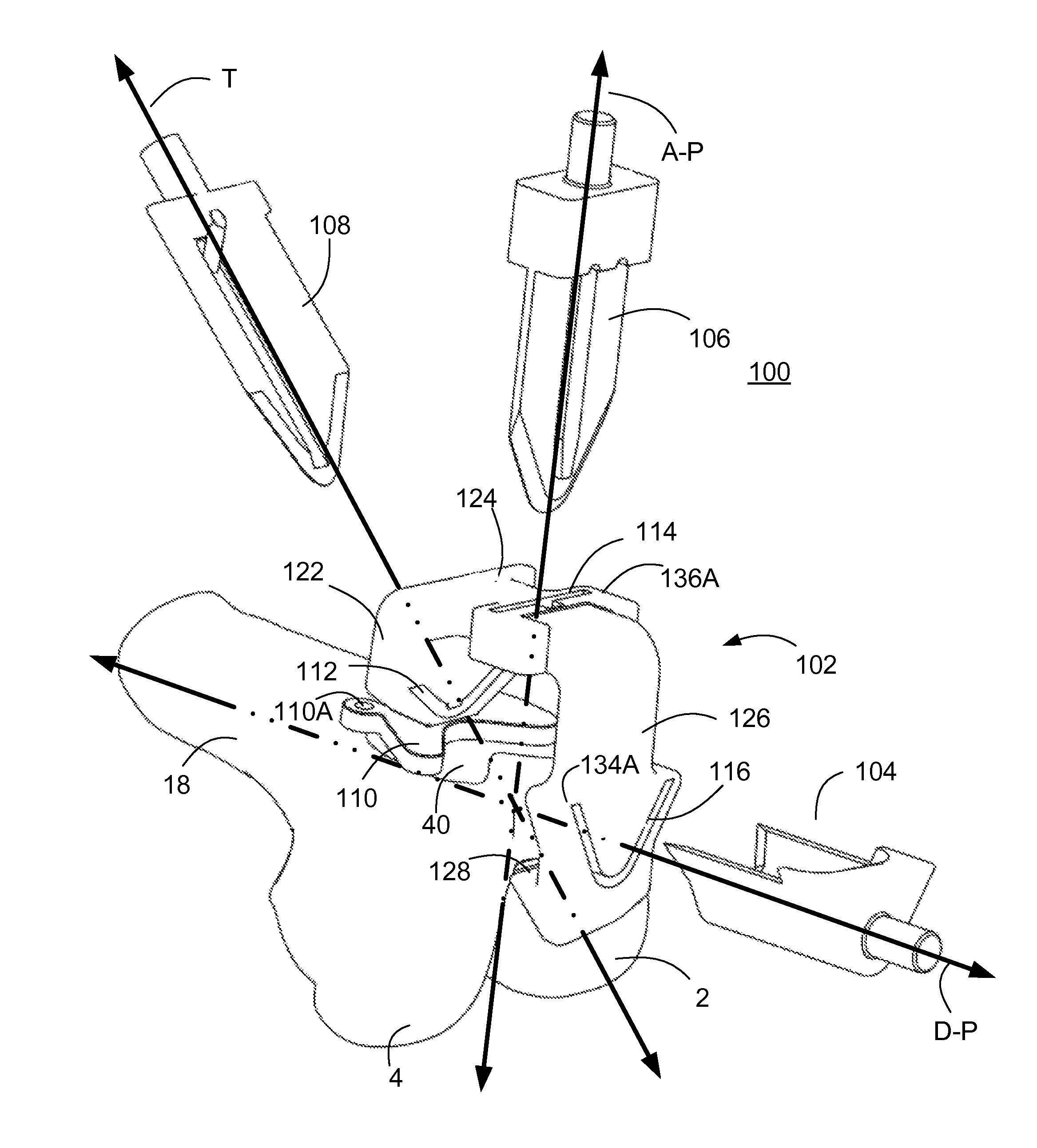 Methods and apparatus for preparing a patient's femur for patellofemoral knee arthroplasty