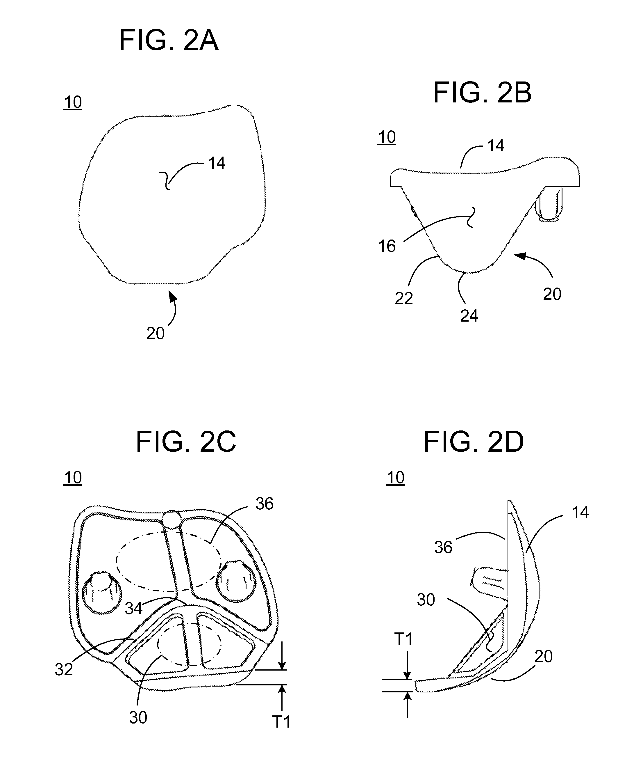 Methods and apparatus for preparing a patient's femur for patellofemoral knee arthroplasty