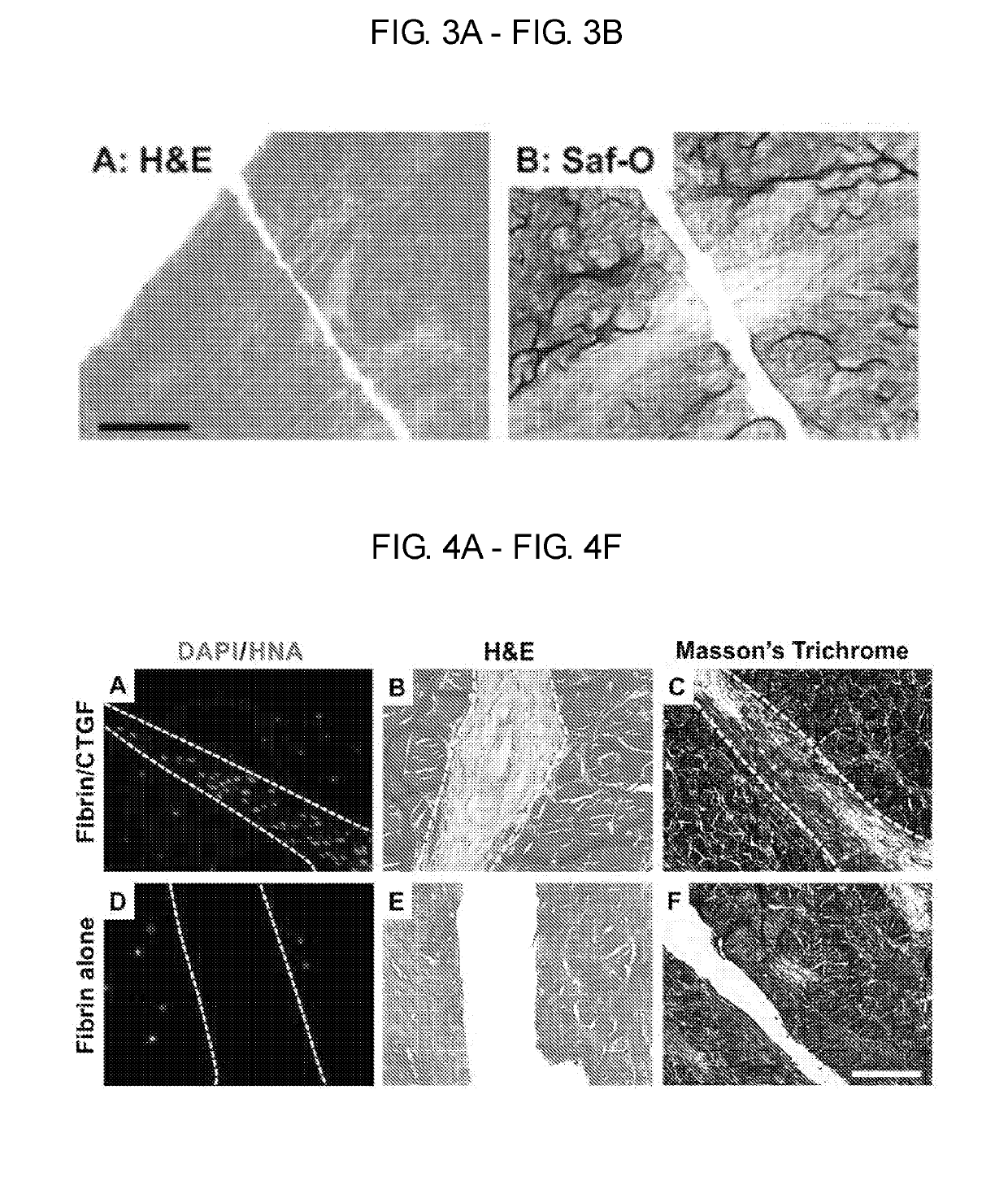 Tissue repair by stem cell recruitment and differentiation