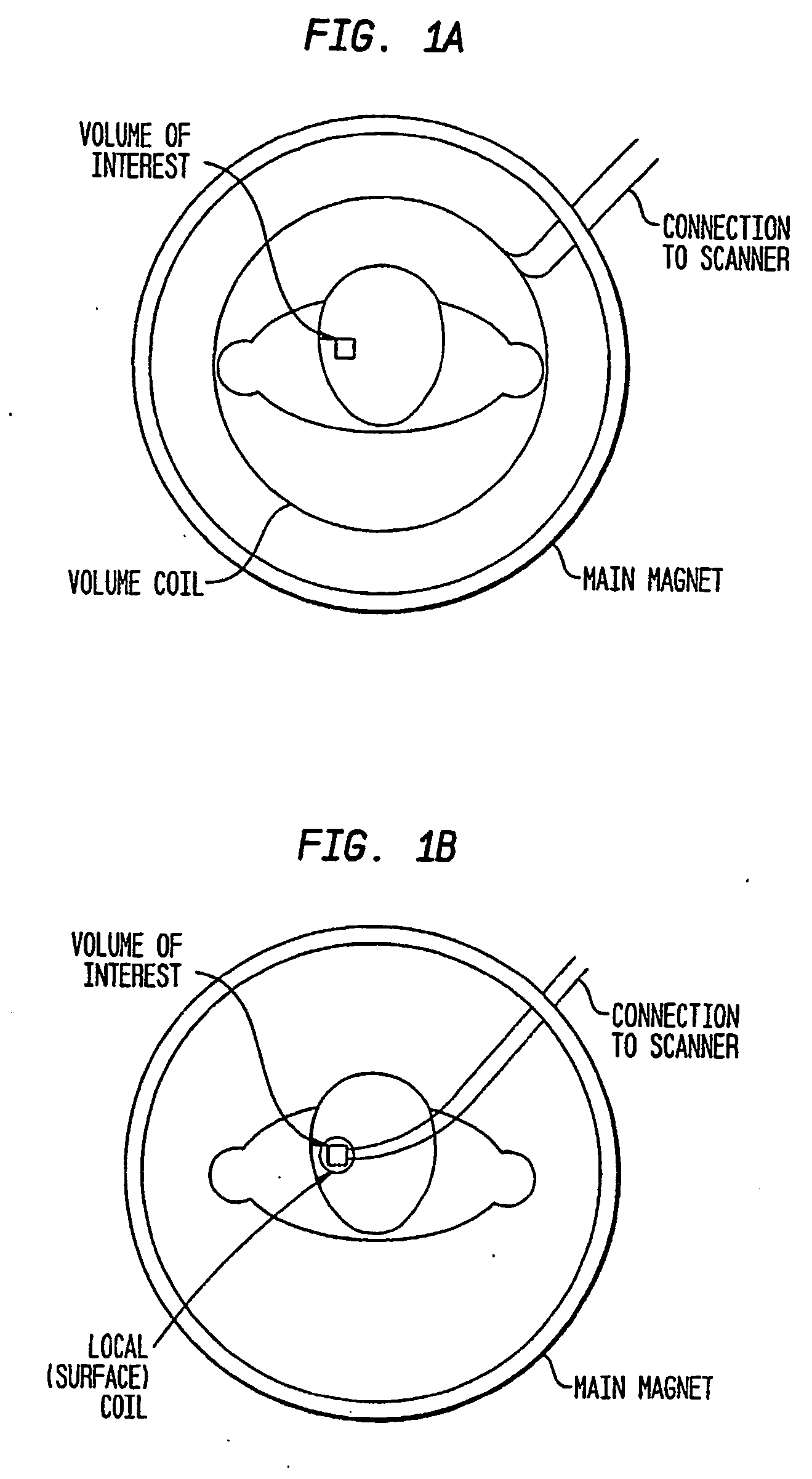 Radiofrequency coil and catheter for surface nmr imaging and spectroscopy