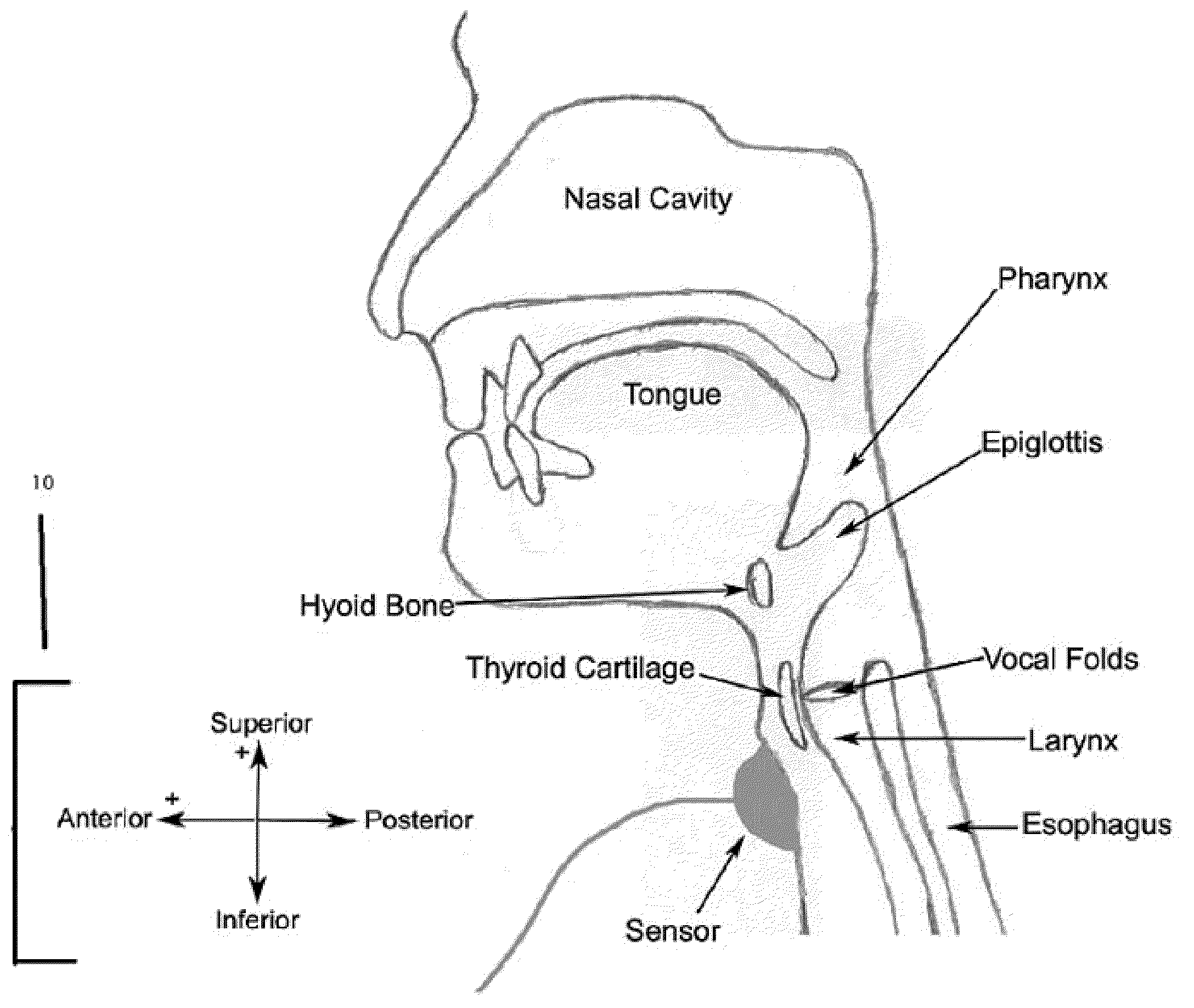 Method and system of segmentation and time duration analysis of dual-axis swallowing accelerometry signals