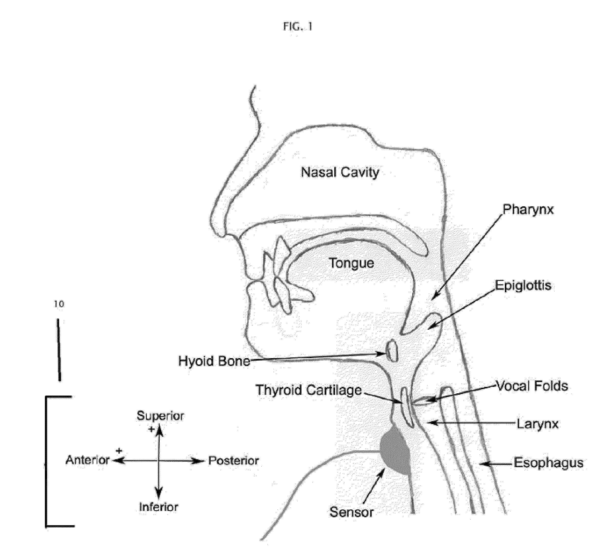 Method and system of segmentation and time duration analysis of dual-axis swallowing accelerometry signals