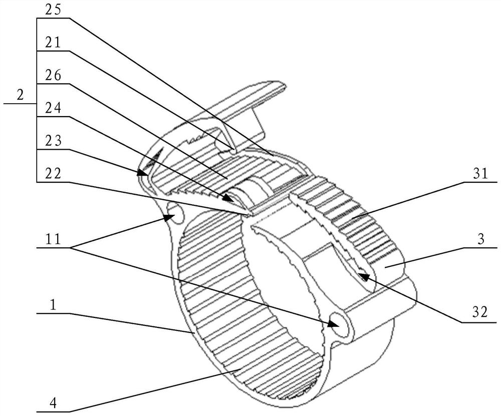 Anastomotic buckle for aorta and artificial blood vessel assembly using same