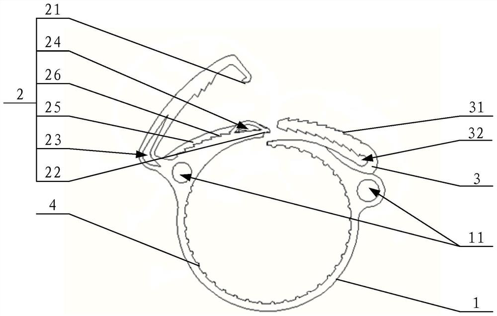 Anastomotic buckle for aorta and artificial blood vessel assembly using same