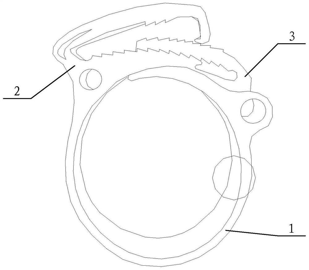 Anastomotic buckle for aorta and artificial blood vessel assembly using same