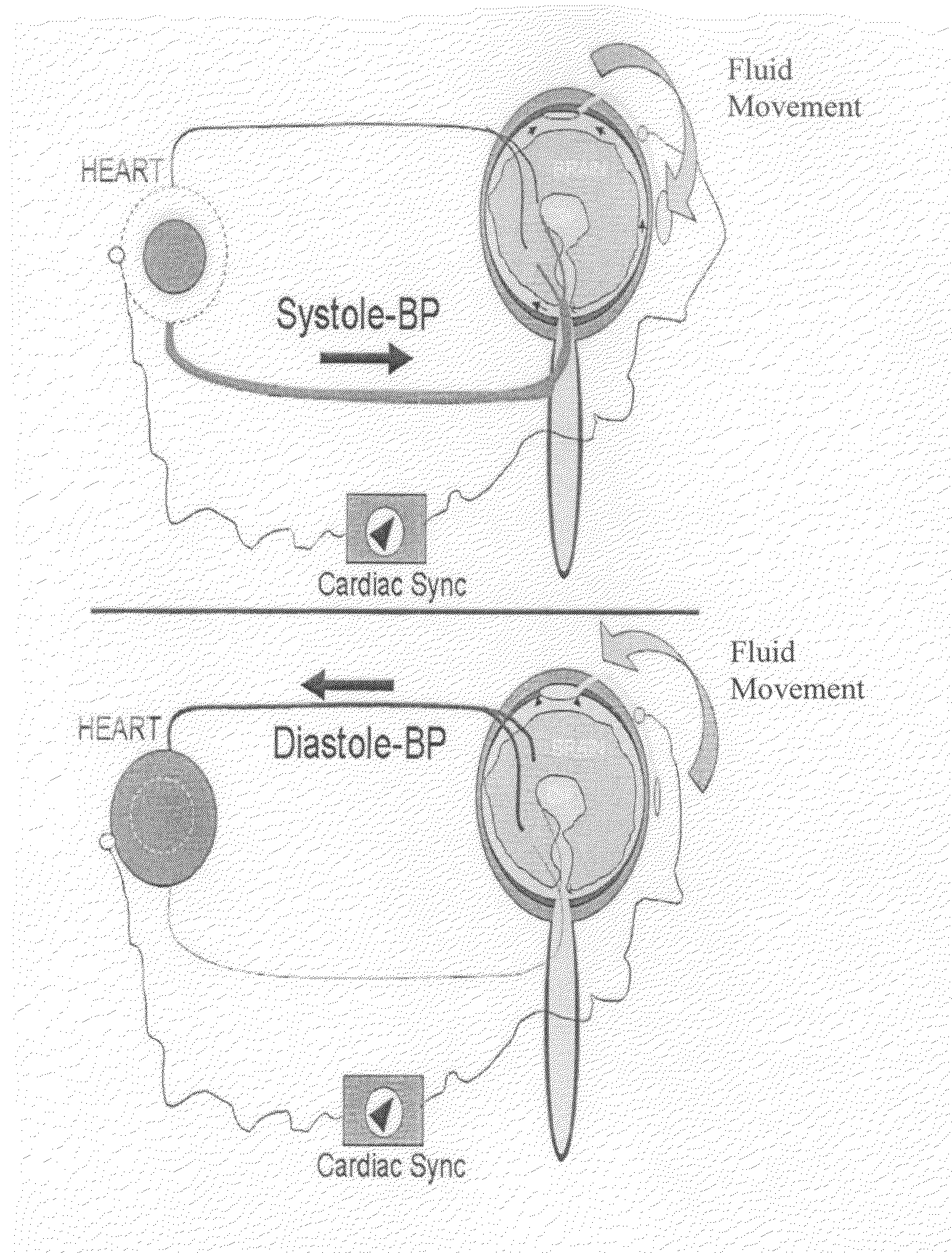 Medical oscillating compliance devices and uses thereof