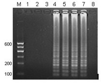 Aflatoxin detection reagent kit based on loop-mediated isothermal gene amplification method