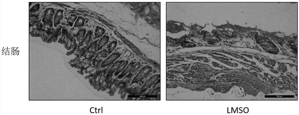 Method for preparing intestinal mucosa injury animal model and applications of model