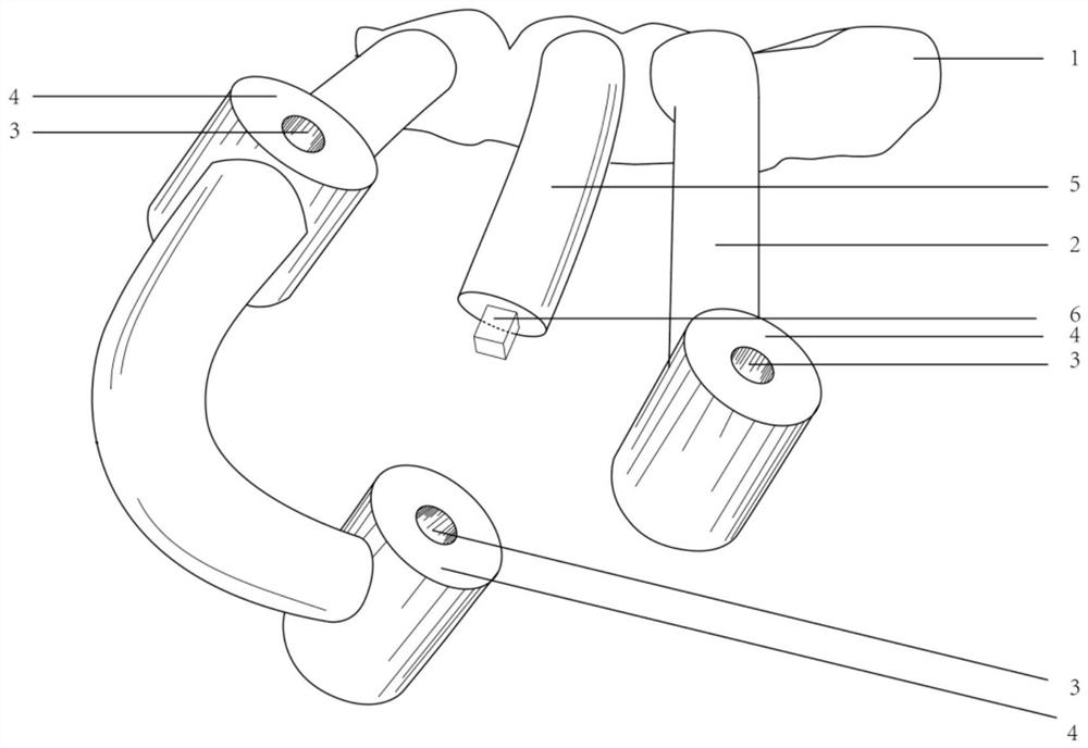 Intraoral combined tooth positioning blocky bone extraction and transplantation whole-course guide plate and manufacturing method thereof