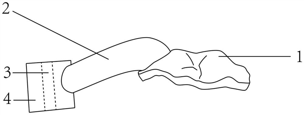 Intraoral combined tooth positioning blocky bone extraction and transplantation whole-course guide plate and manufacturing method thereof