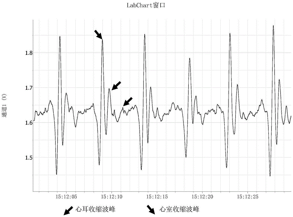 Scallop heartbeat index based rapid seed selection method