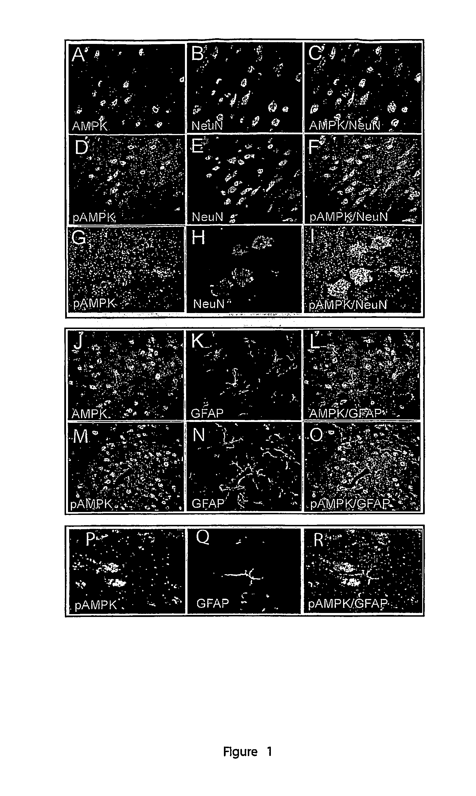 Method of neuroprotection by pharmacological inhibition of AMP-activated protein kinase