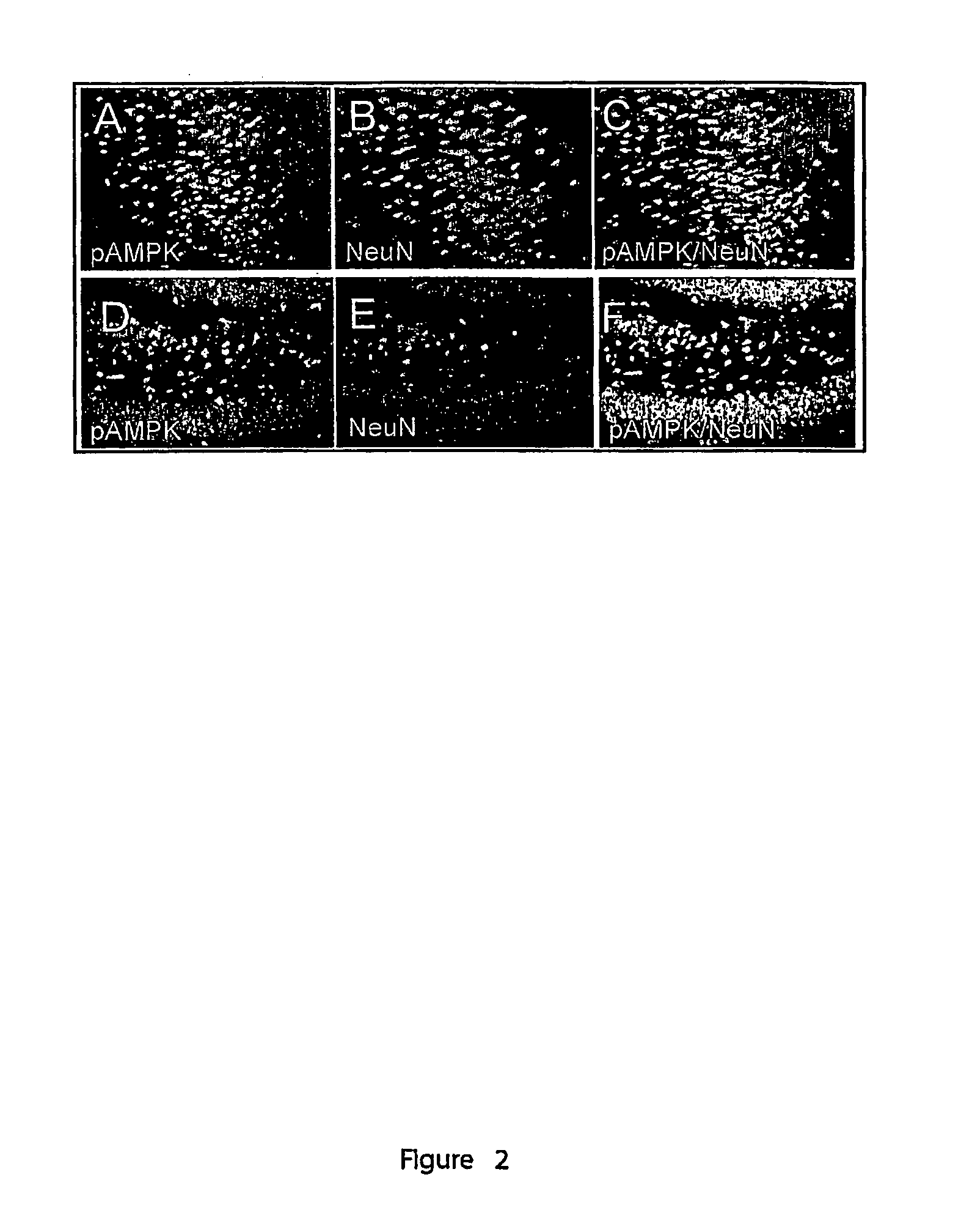 Method of neuroprotection by pharmacological inhibition of AMP-activated protein kinase