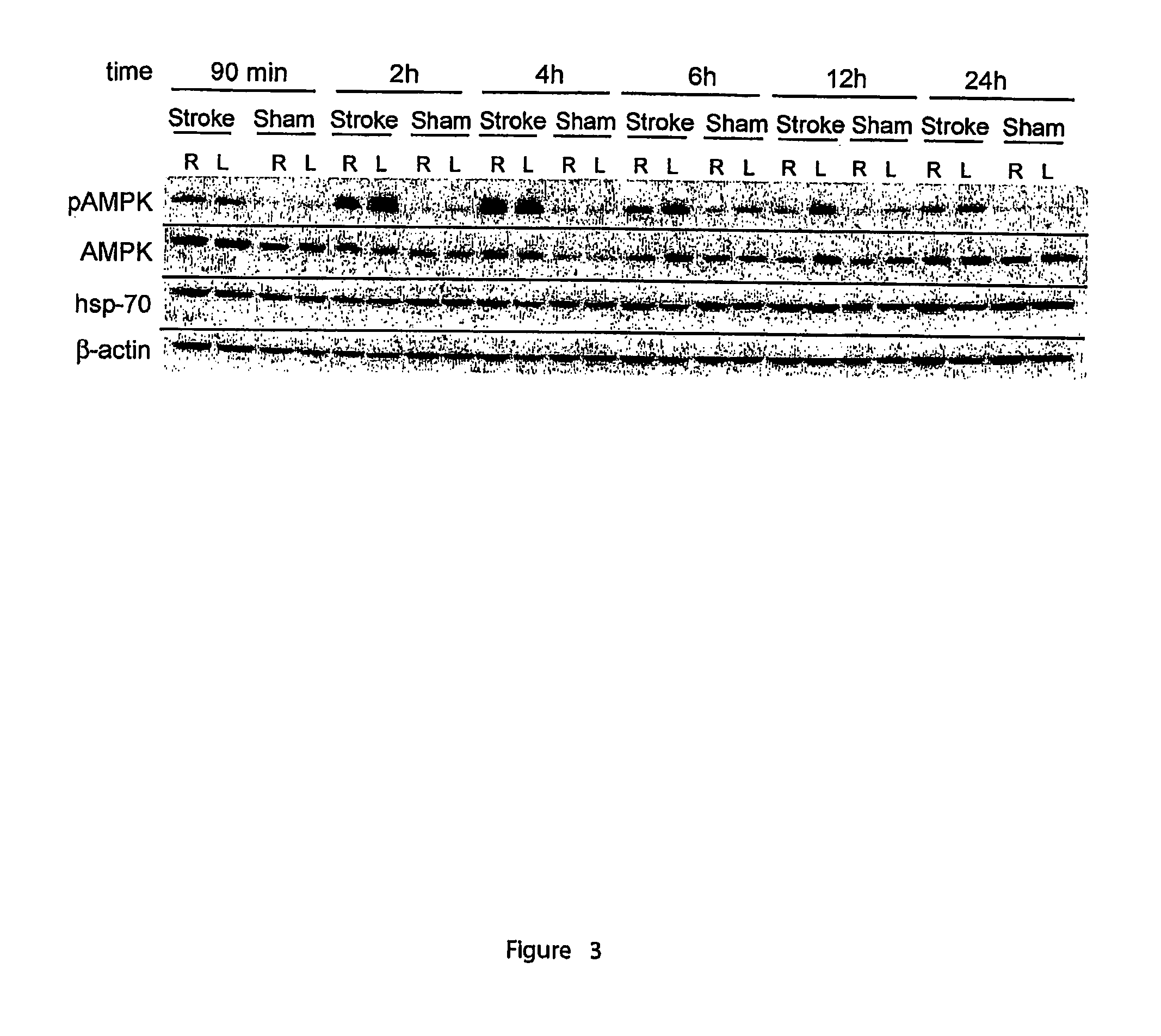 Method of neuroprotection by pharmacological inhibition of AMP-activated protein kinase