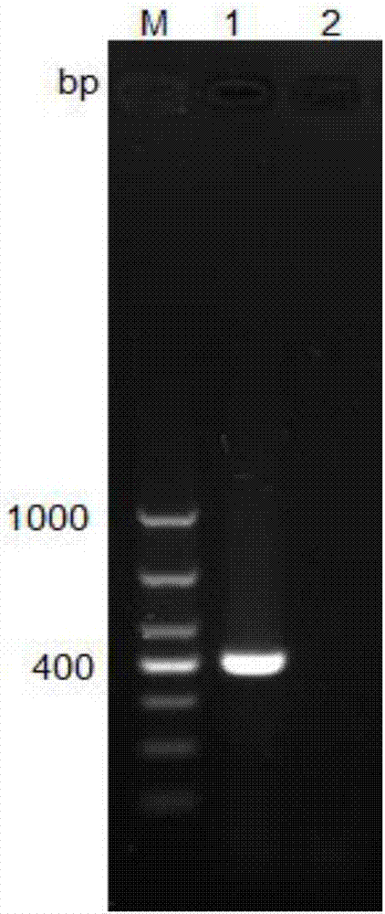 Salmonella Indiana PCR (polymerase chain reaction) detection kit and non-diagnosis detection method thereof