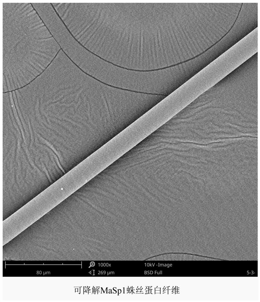 Absorbable medical suture and preparation method thereof