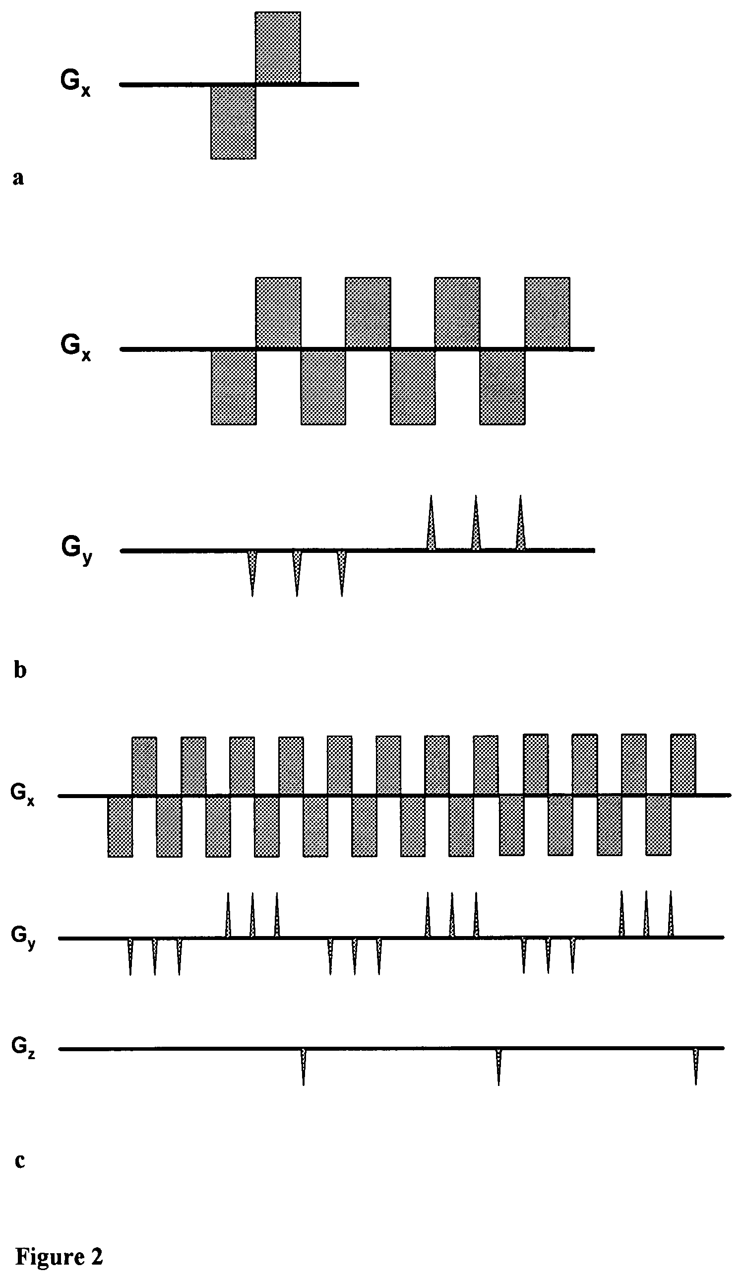 Magnetic resonance spectroscopy with sparse spectral sampling and interleaved dynamic shimming