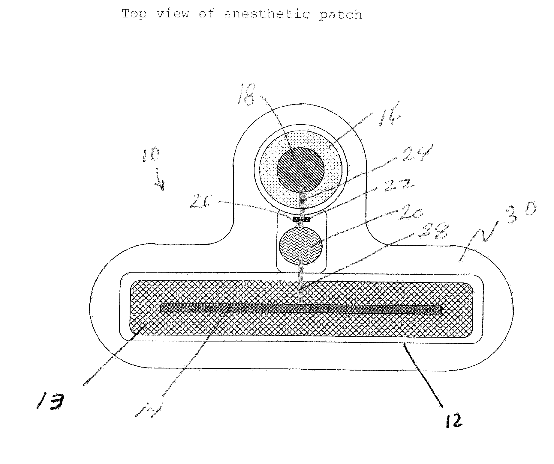 Transdermal Systems for the Delivery of Ionic Agents Directly to Open Wounds and Surgically Repaired Incisions