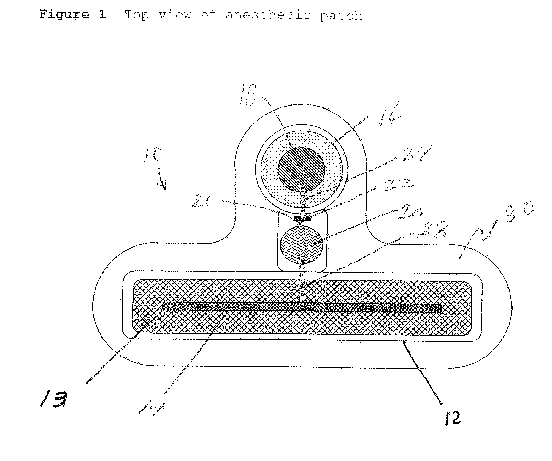 Transdermal Systems for the Delivery of Ionic Agents Directly to Open Wounds and Surgically Repaired Incisions