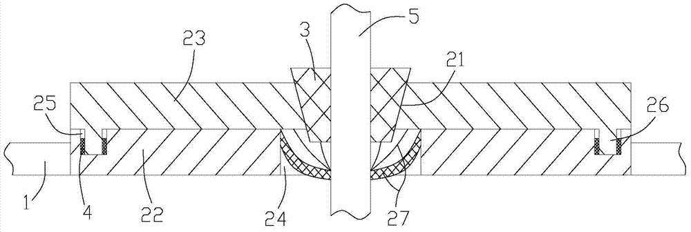 A hysteroscope anti-leakage device