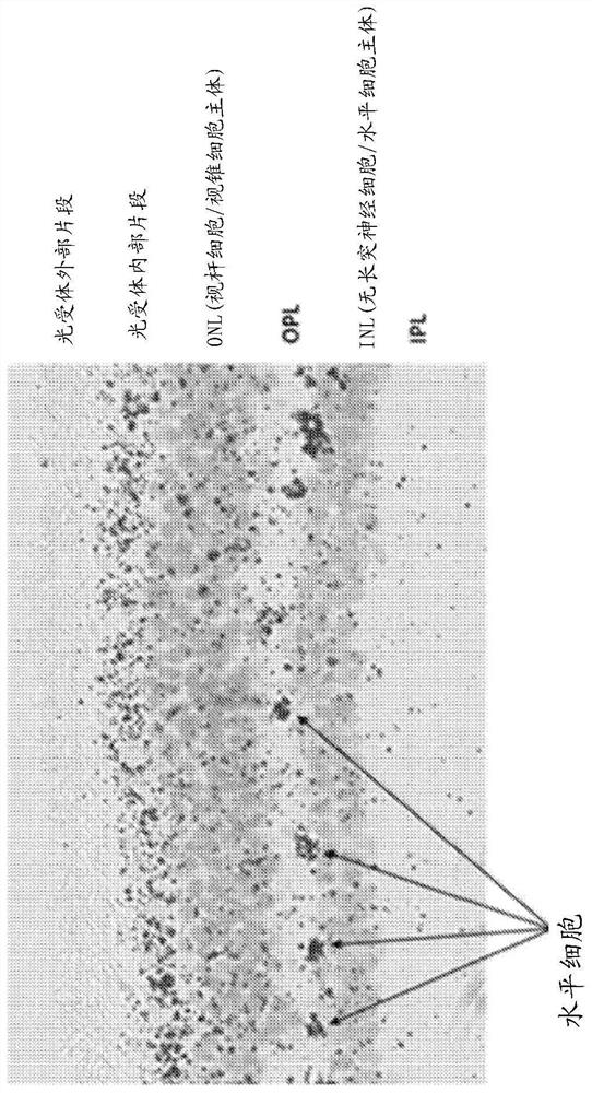 Htra1 modulation for treatment of AMD