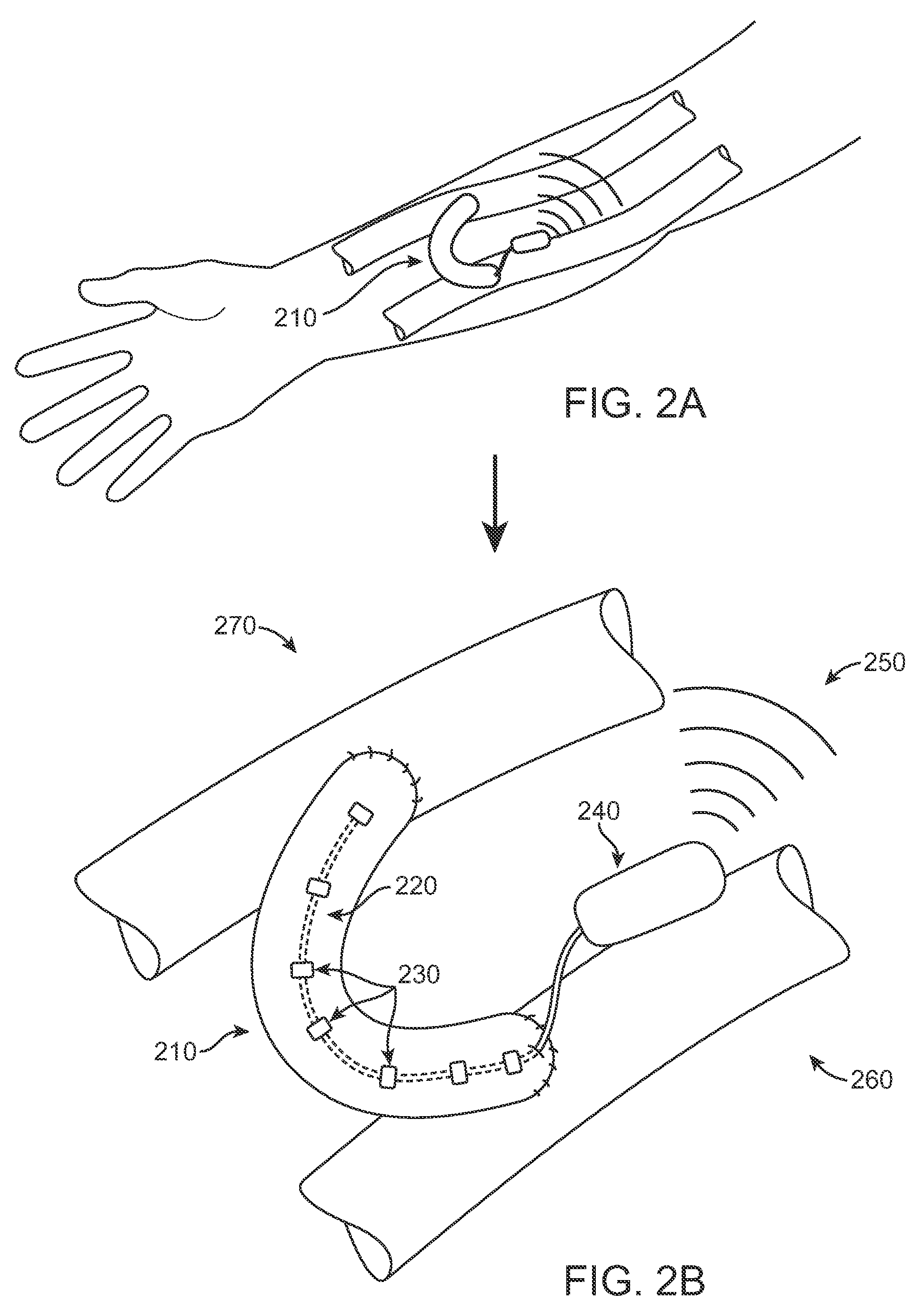 Body-associated fluid transport structure evaluation devices