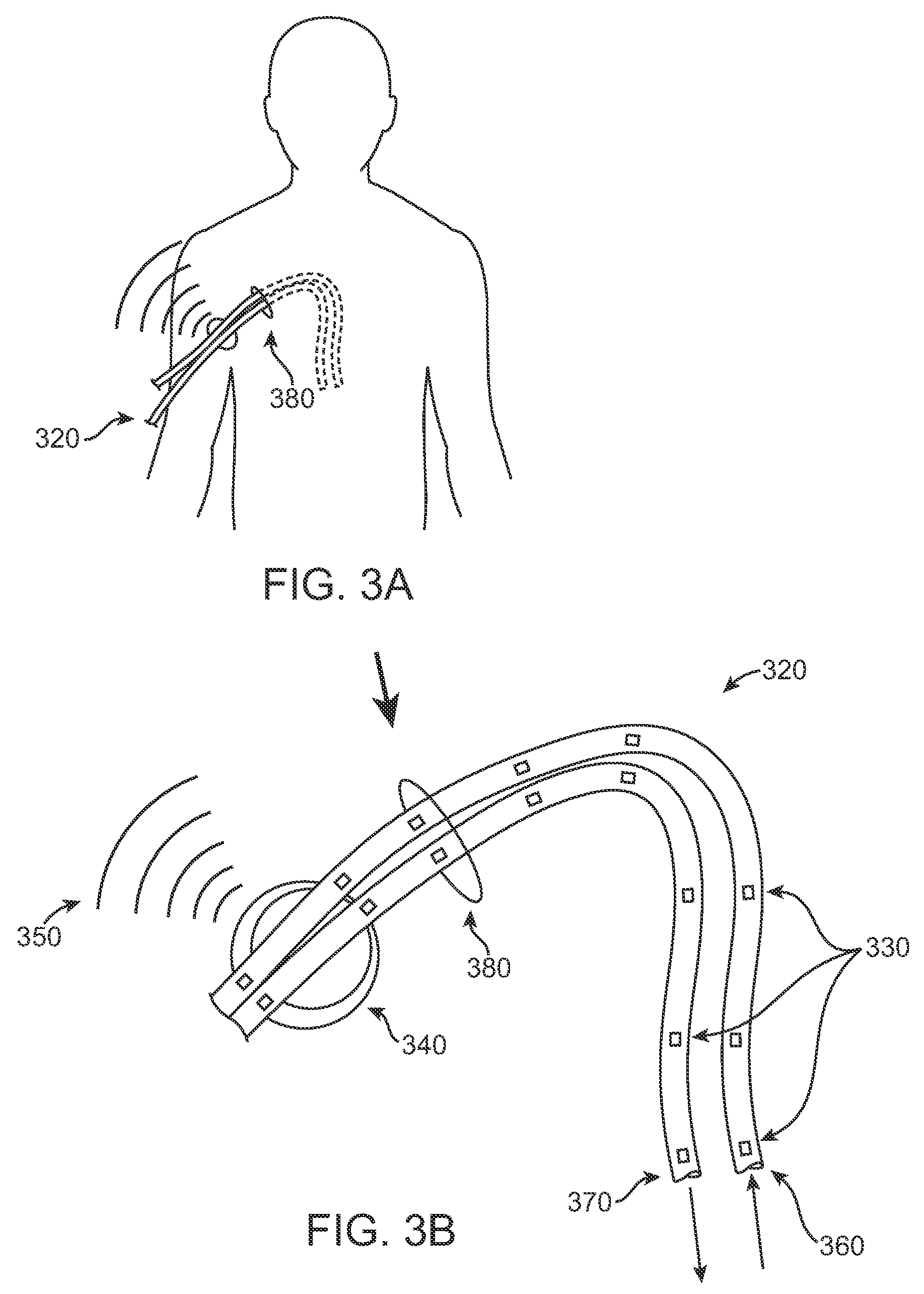 Body-associated fluid transport structure evaluation devices