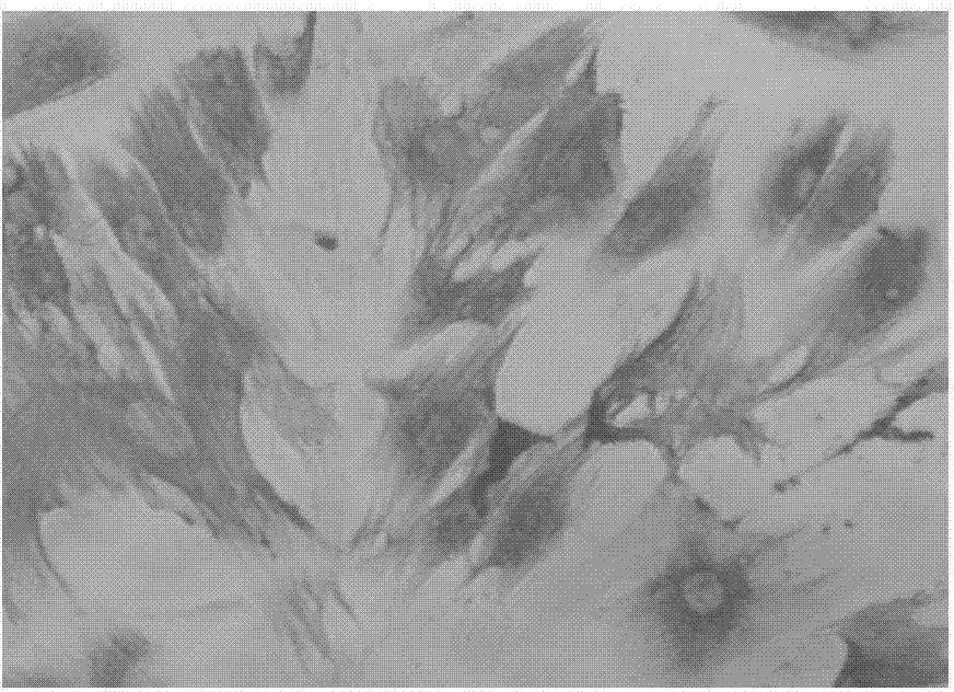 Tissue- engineered cartilage graftimplant and preparation method thereof