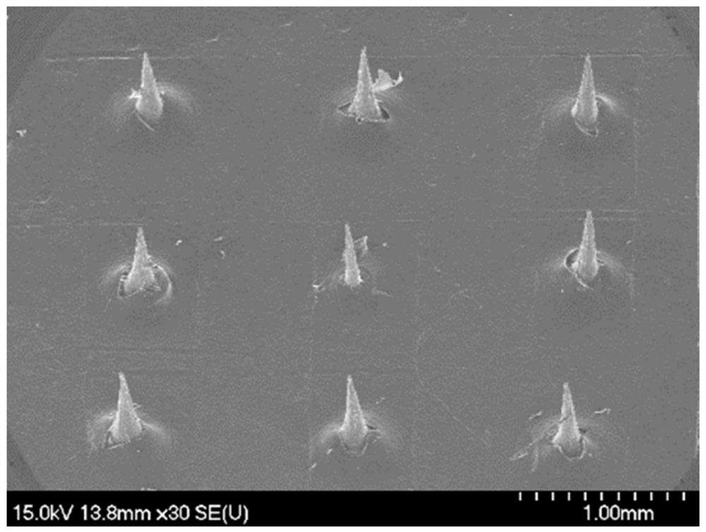 Microneedle for treating psoriasis through percutaneous delivery of lipidosome and preparation method of microneedle