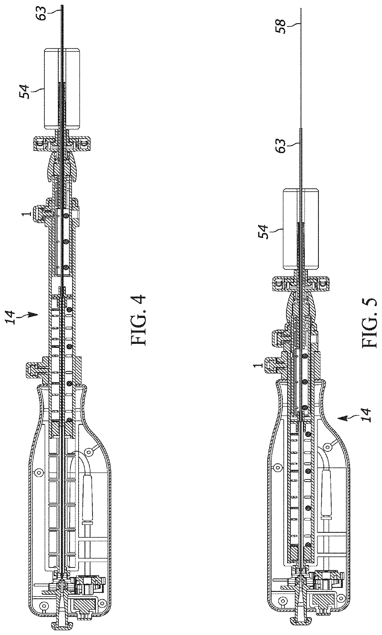 Telescoping needle assembly with side cutting needle