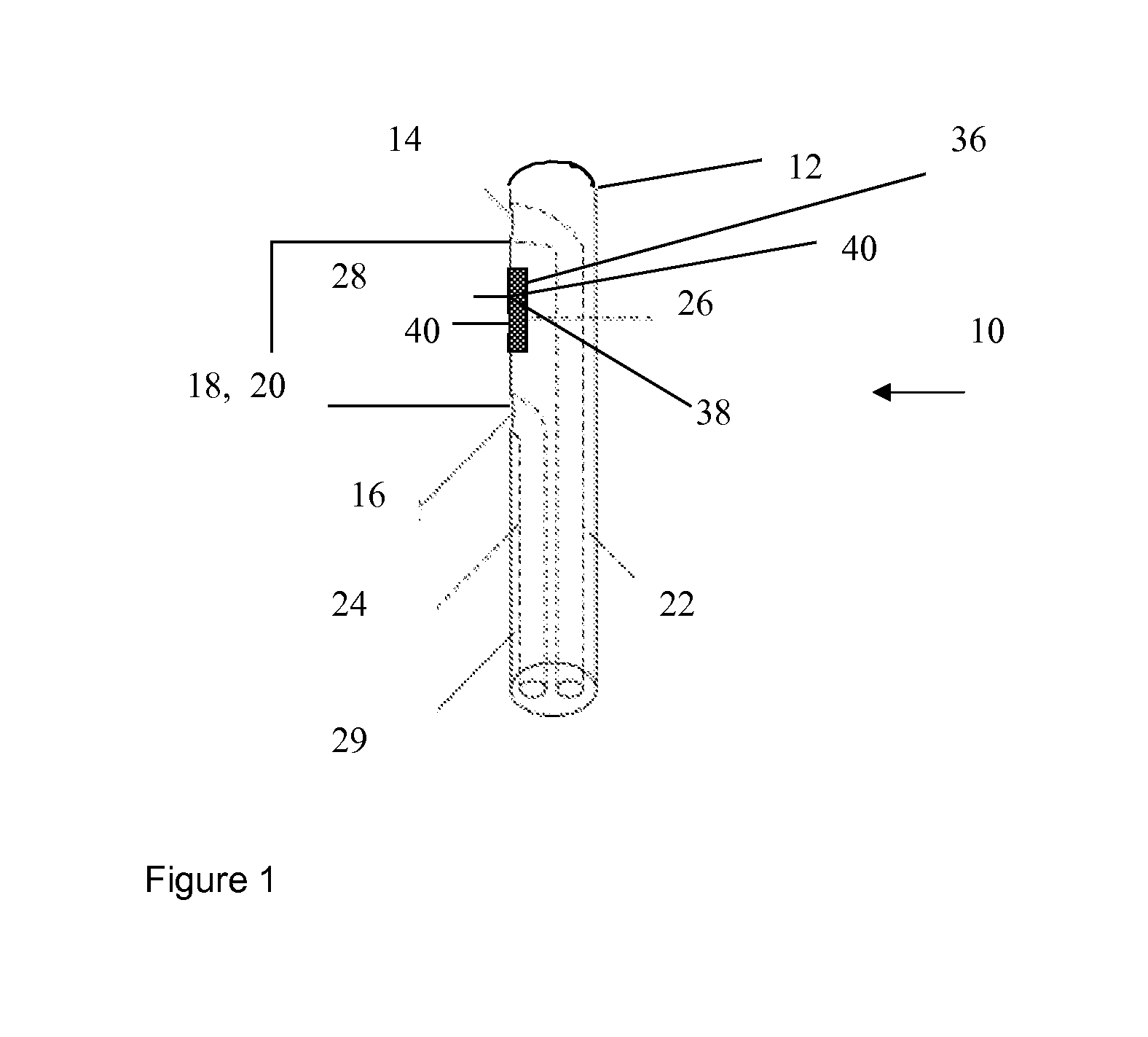 Method and device for determining dysfunction of the heart