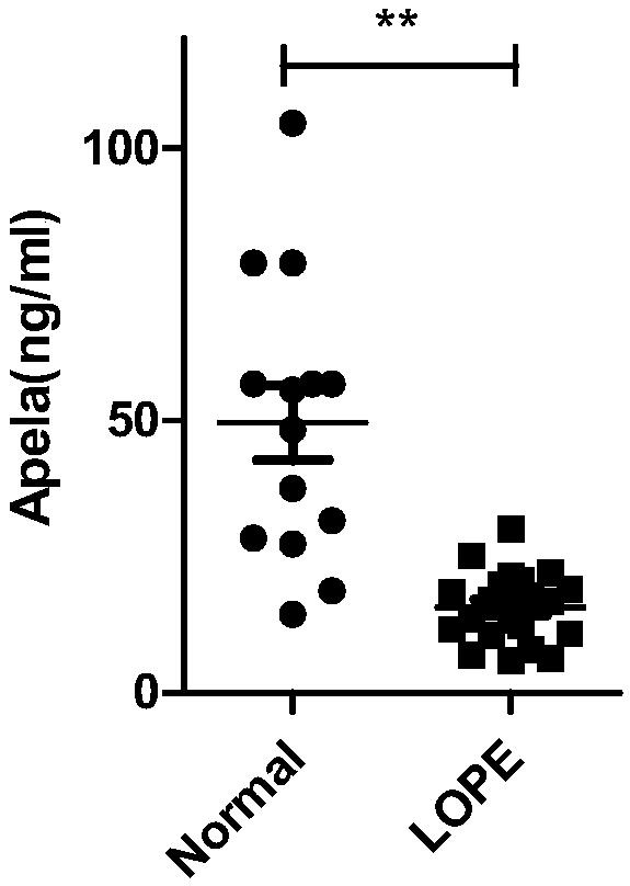 Test paper and kit for quickly screening late onset severepre-eclampsia