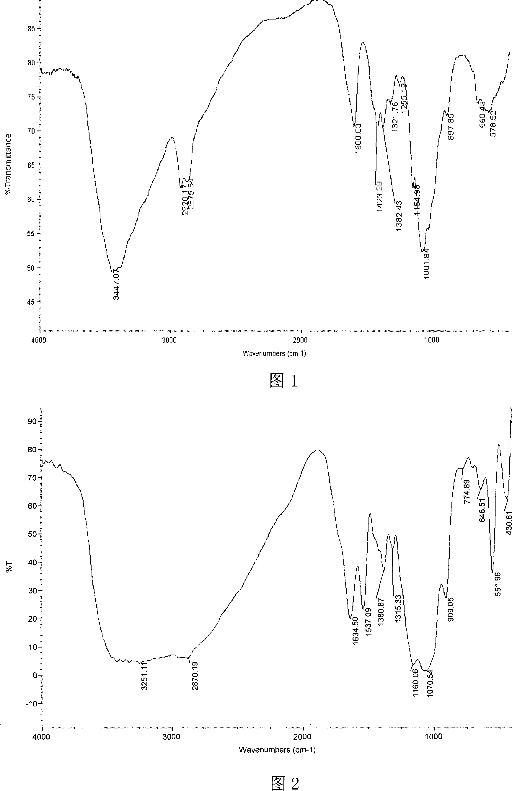 Chitosan alpha-aminoalkyl phosphonate ester derivative and preparation method thereof