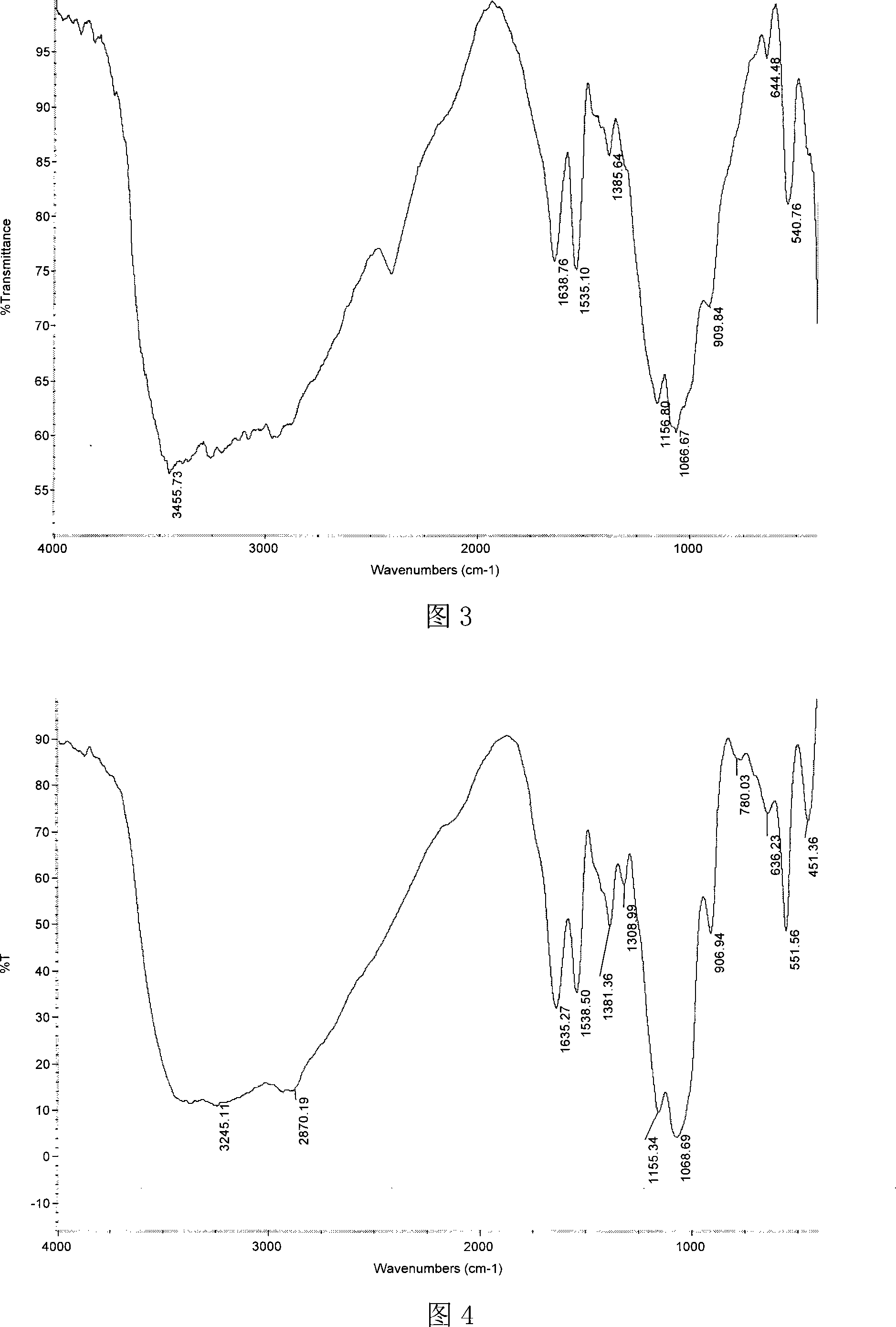 Chitosan alpha-aminoalkyl phosphonate ester derivative and preparation method thereof