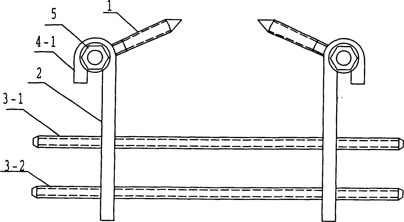 Pelvis and spinal column position restoring and internal fixing device for treating lumbar vertebrae olisthy olisthe