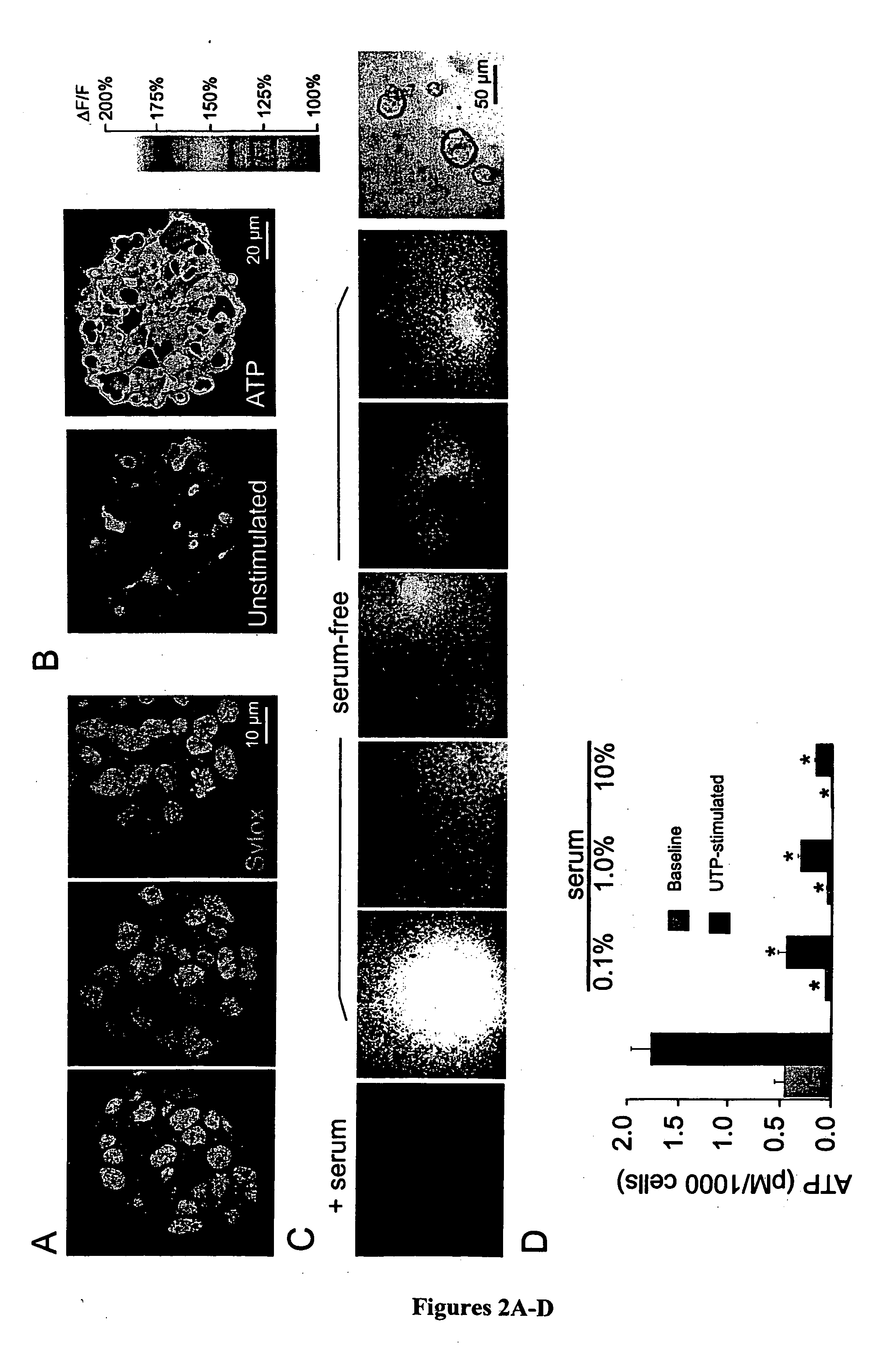 Purines are self-renewal signals for neural stem cells, and purine receptor antagonists promote neuronal and glial differentiation therefrom