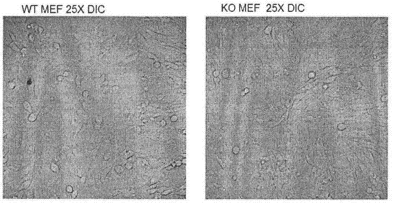 A preparation method and application of an antineoplastic drug screening model targeting 4.1r and CD29