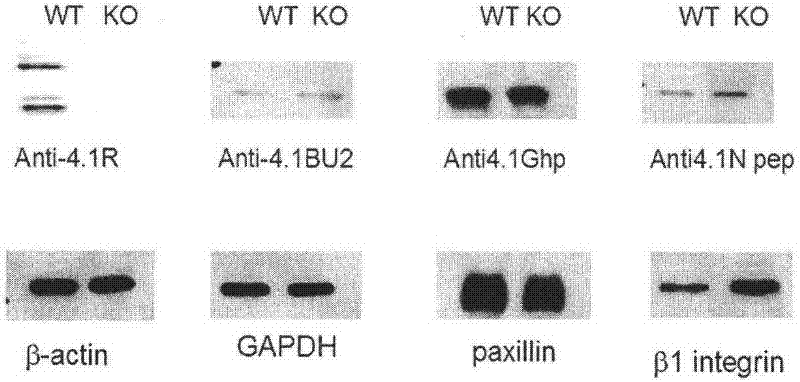 A preparation method and application of an antineoplastic drug screening model targeting 4.1r and CD29