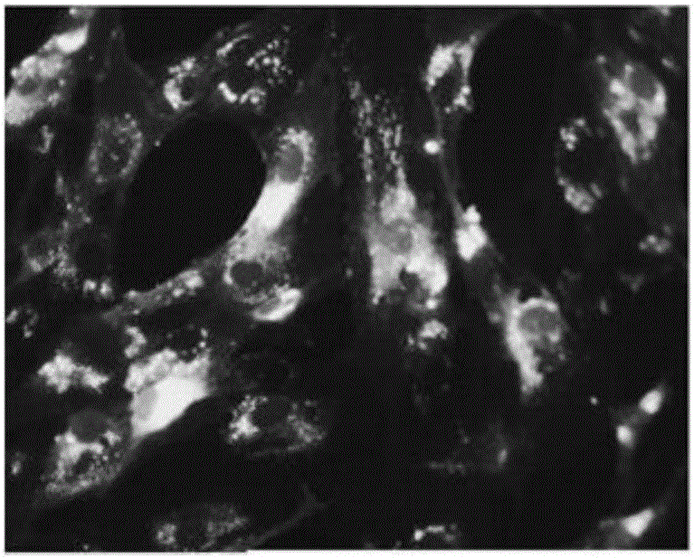 Recombinant mesenchymal stem cells, preparation method and application thereof