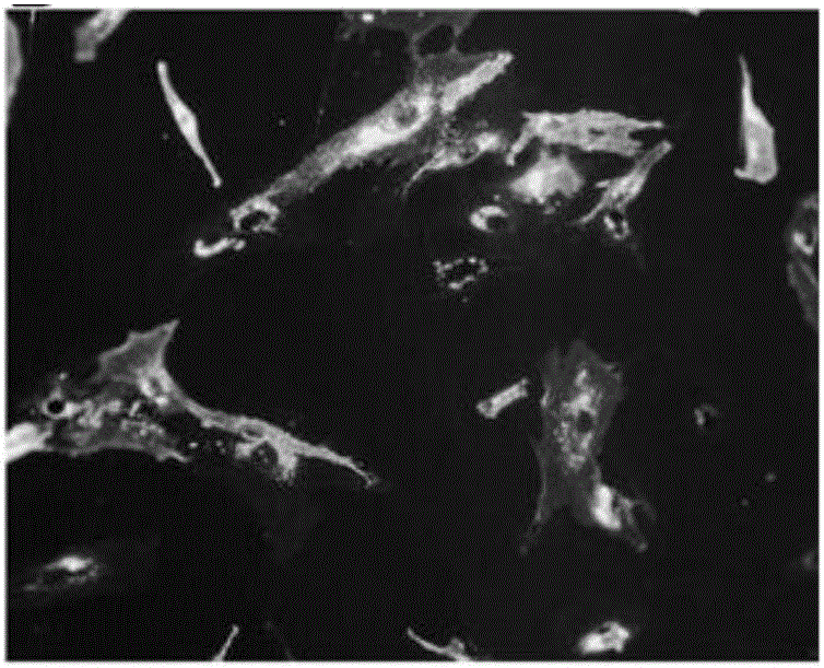 Recombinant mesenchymal stem cells, preparation method and application thereof