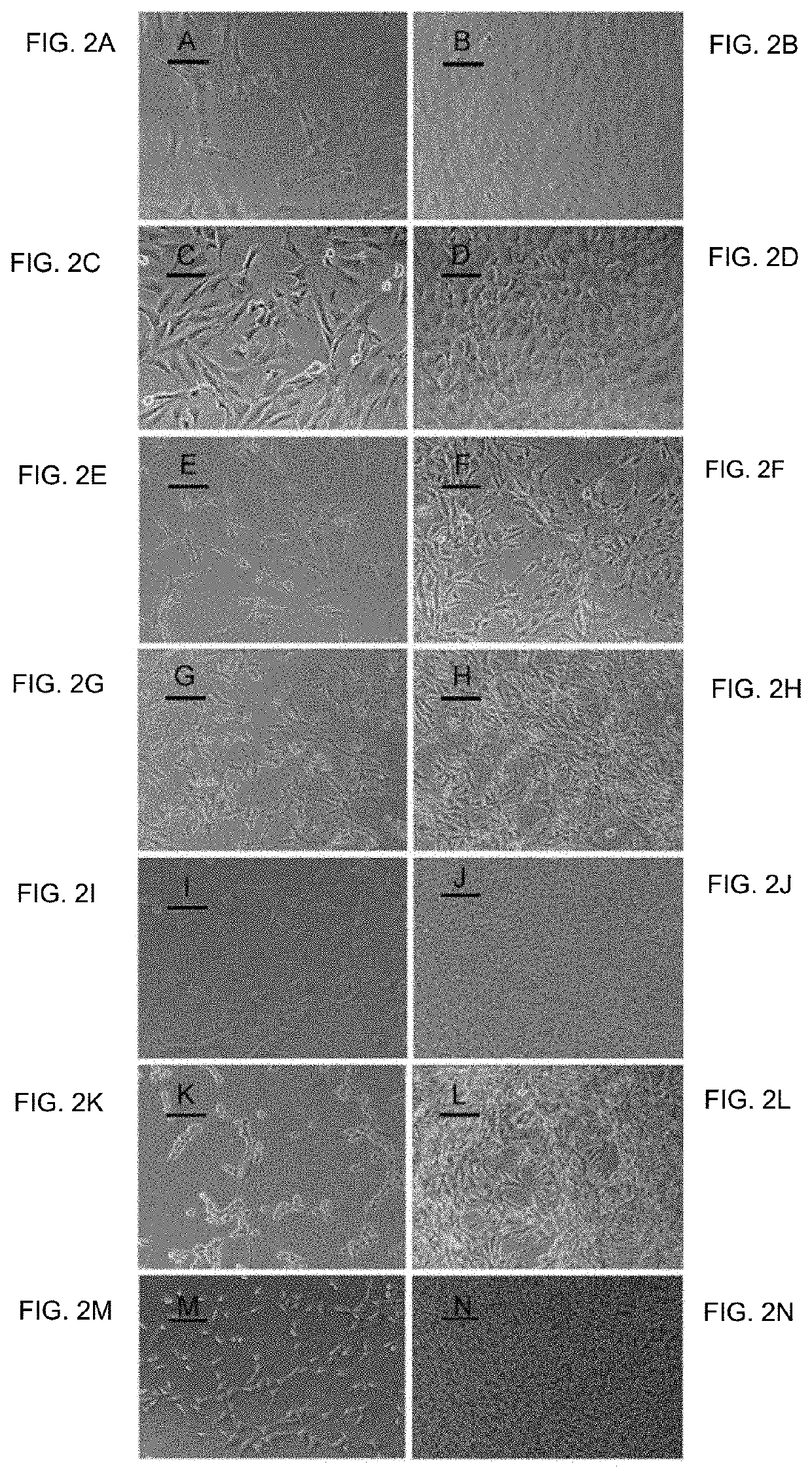 Progressively tumorigenic cell lines