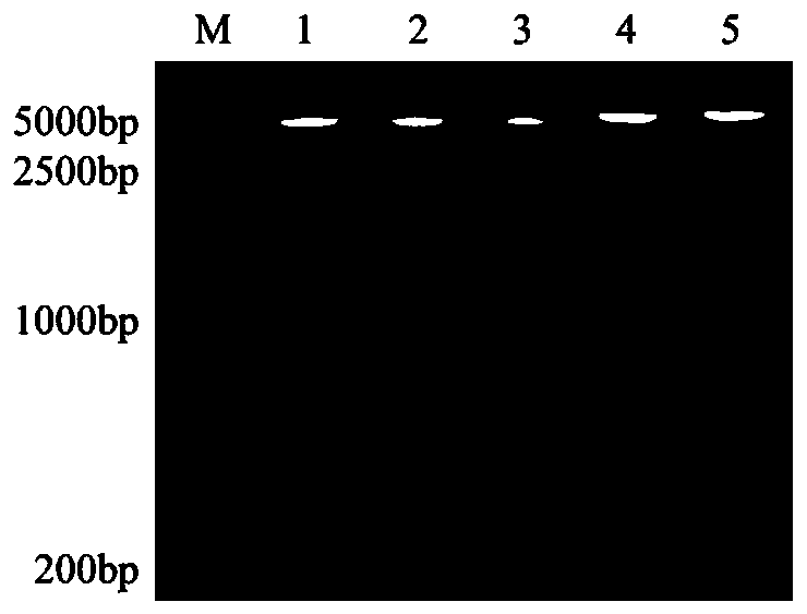 Swine streptococcicosis-Glasser's disease bivalent subunit vaccine and preparation method thereof