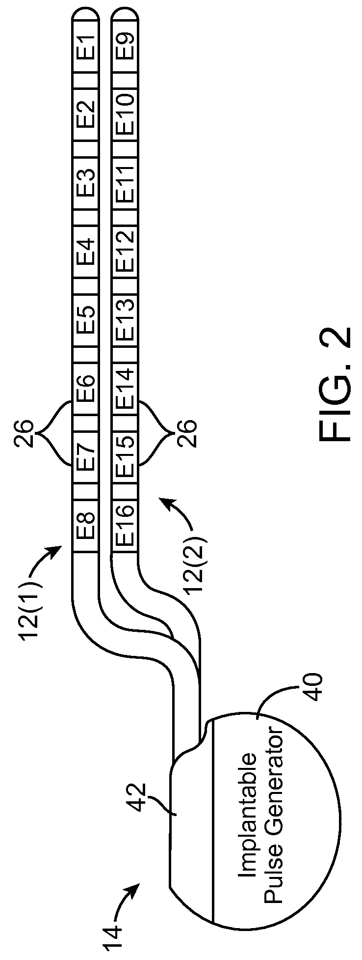 Neurostimulation system and method for providing therapy to patient with minimal side effects