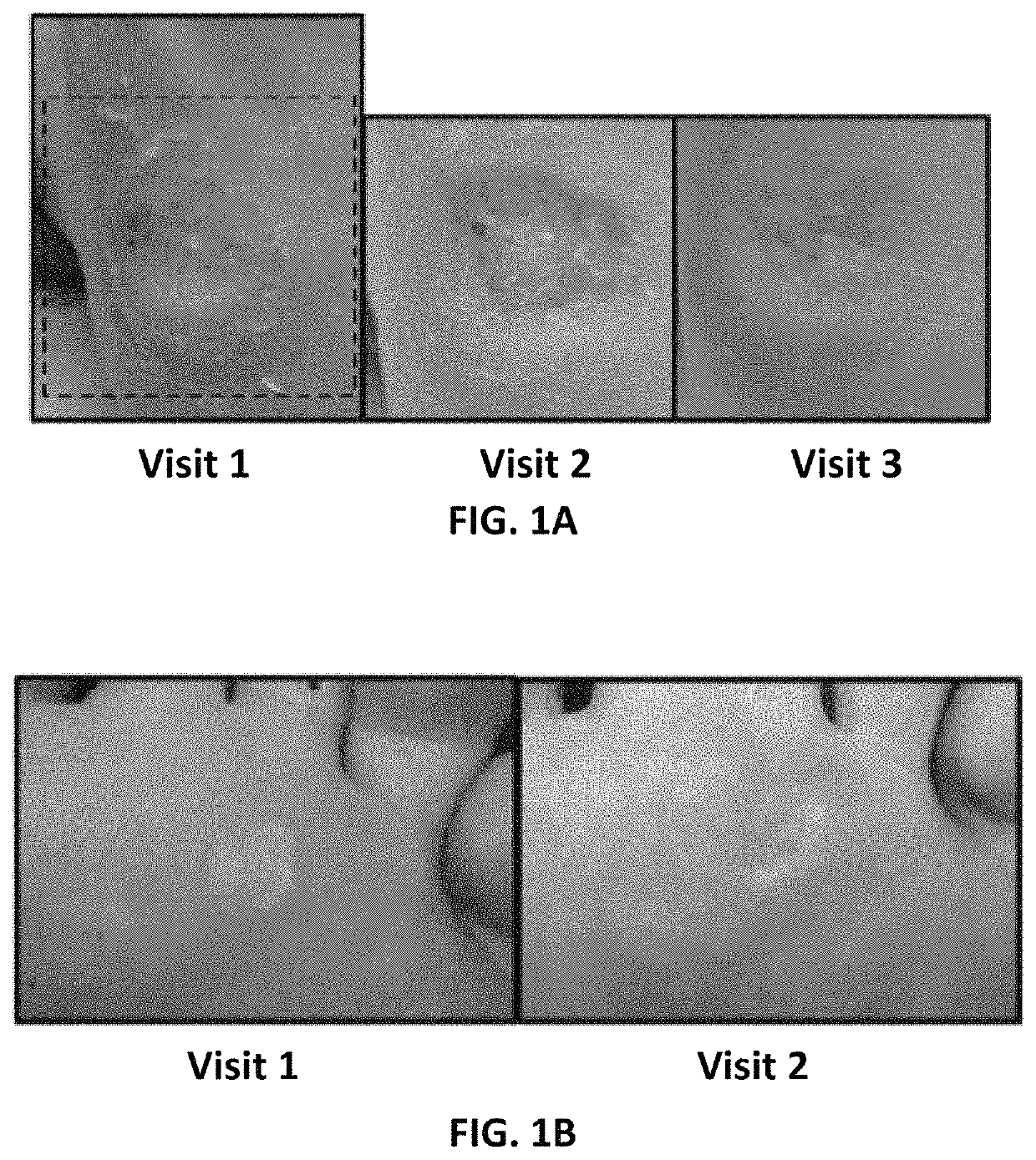 Method and apparatus for the treatment, management and/or control of pain